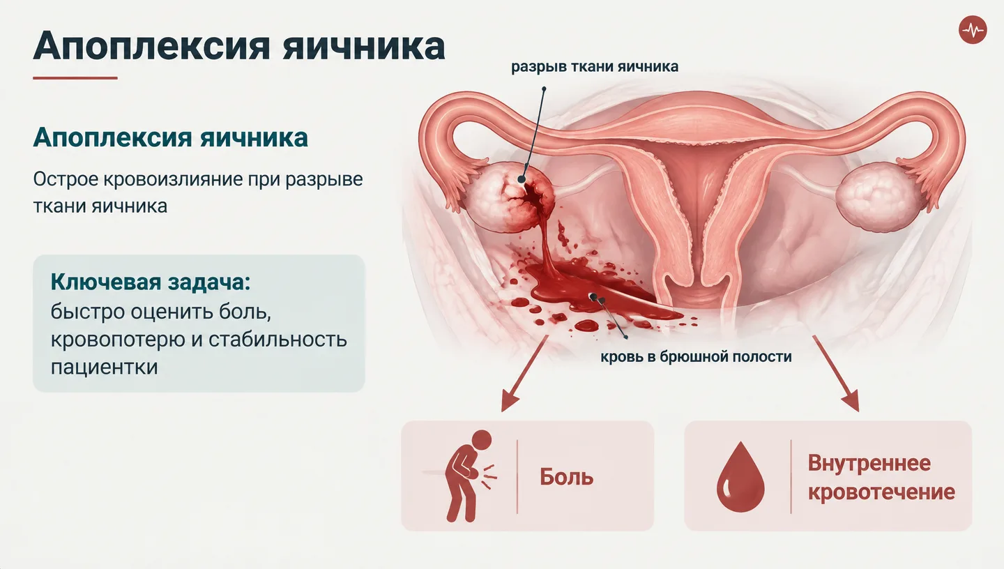 Первый слайд: Апоплексия яичника