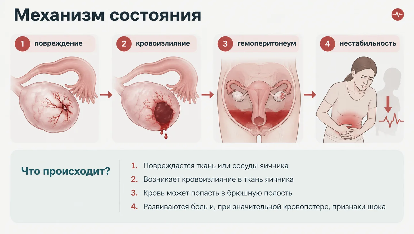 Механизм состояния