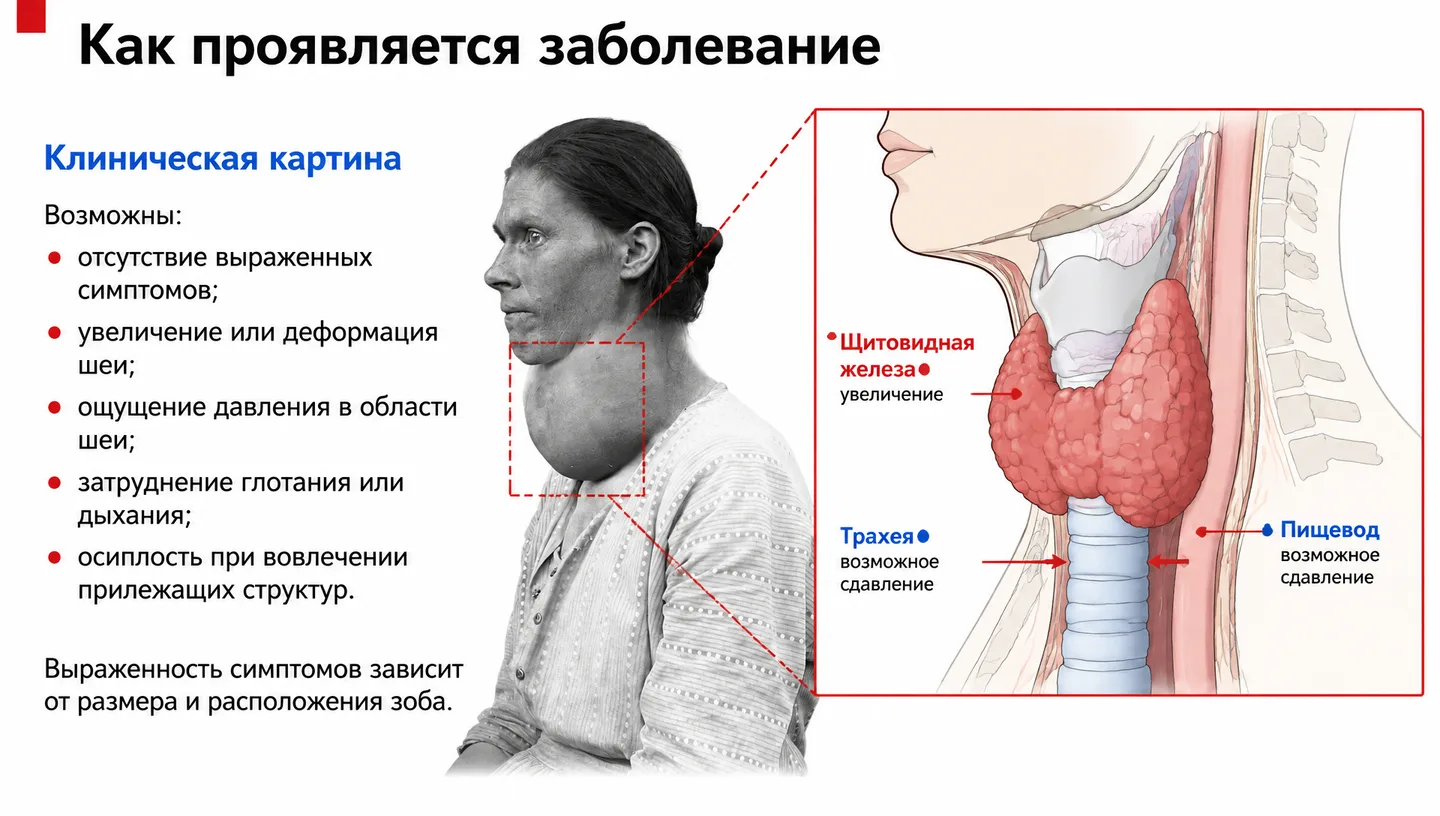 Как проявляется заболевание