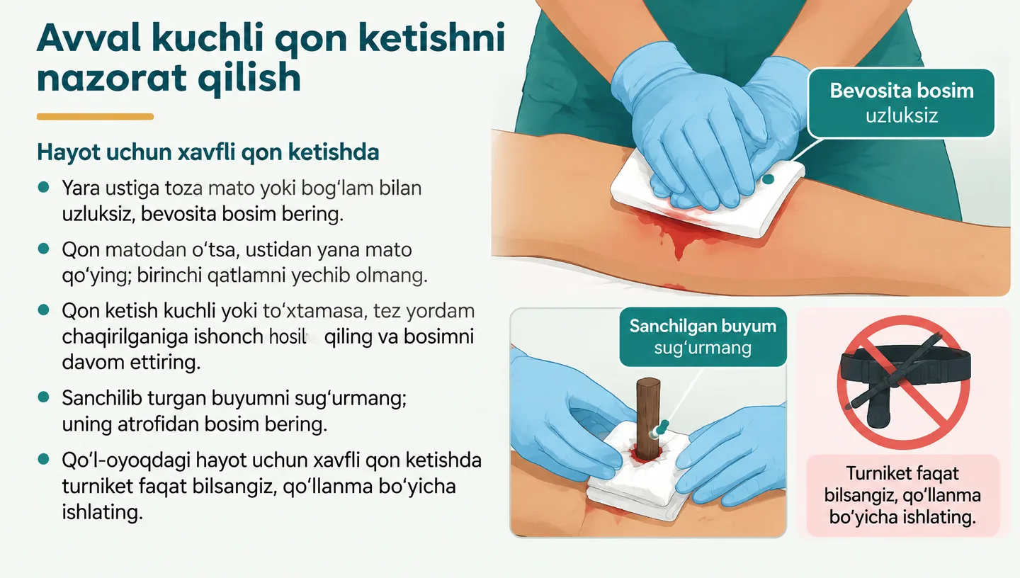Avval kuchli qon ketishni nazorat qilish
