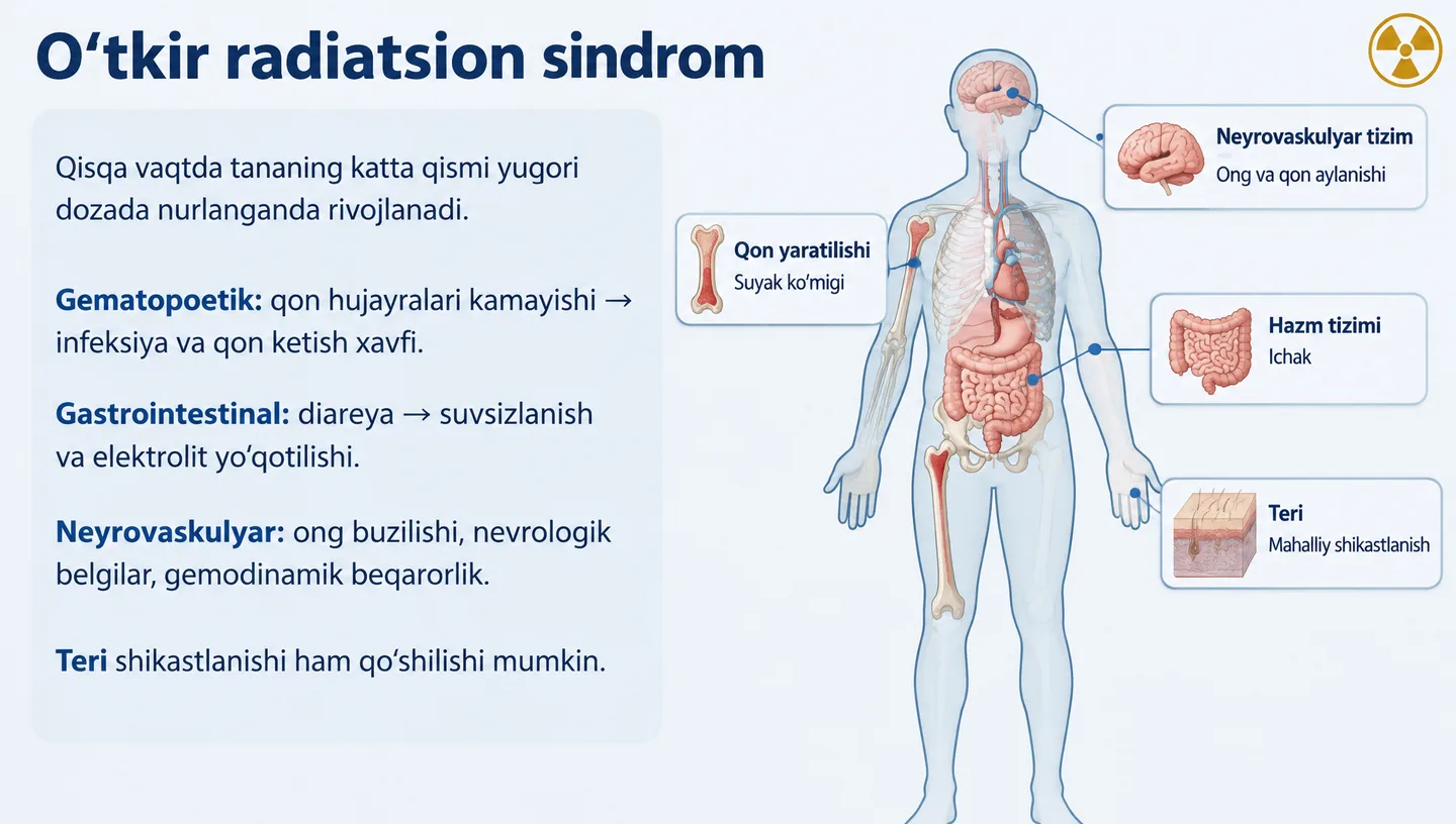 O‘tkir radiatsion sindrom