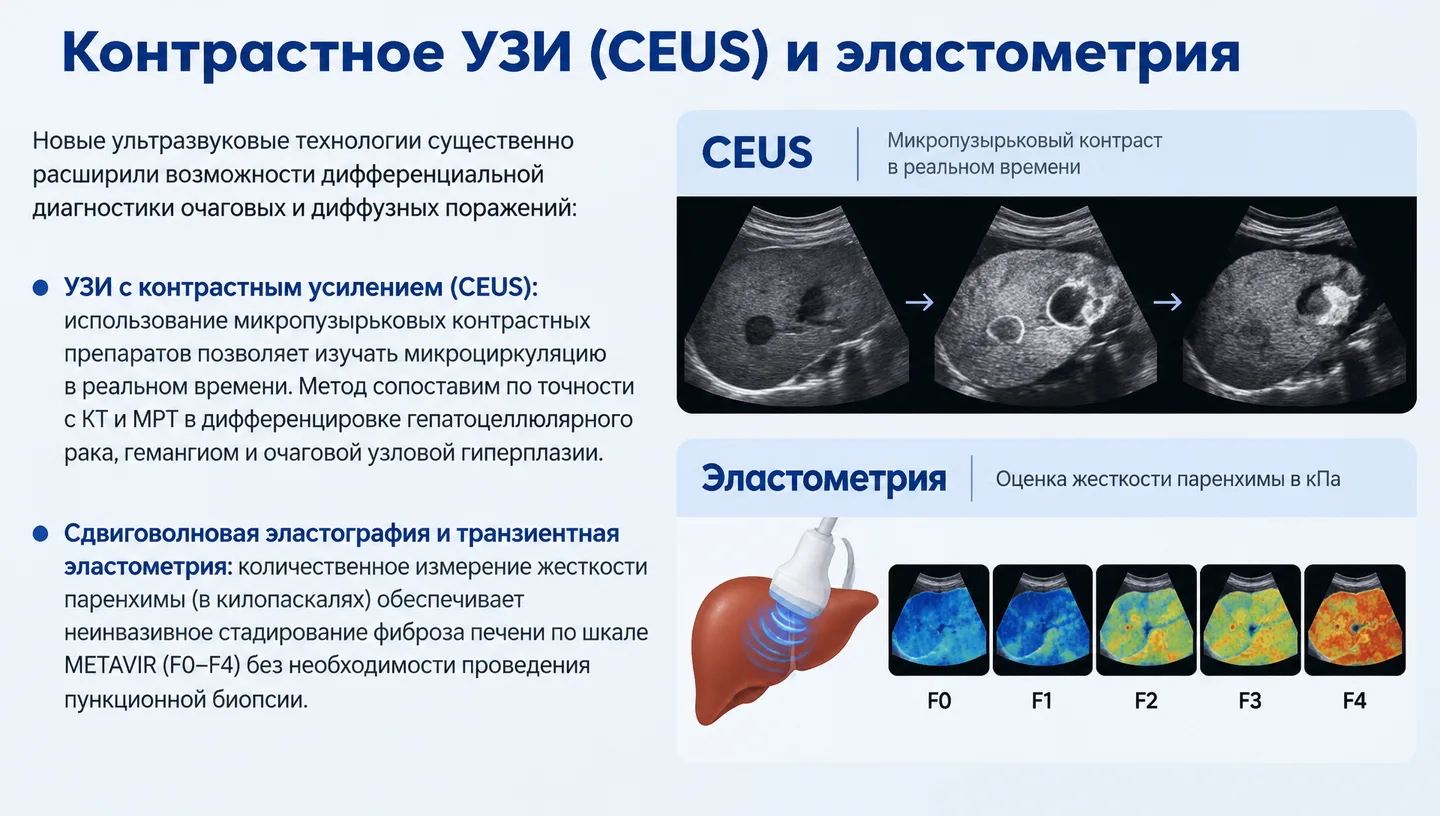 Контрастное УЗИ (CEUS) и эластометрия