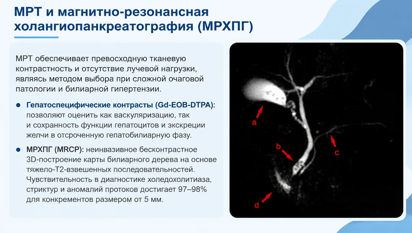 МРТ и магнитно-резонансная холангиопанкреатография (МРХПГ)