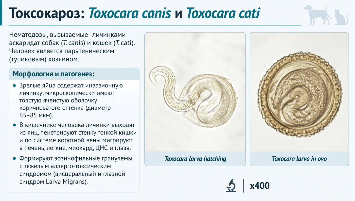 Токсокароз: Toxocara canis и Toxocara cati